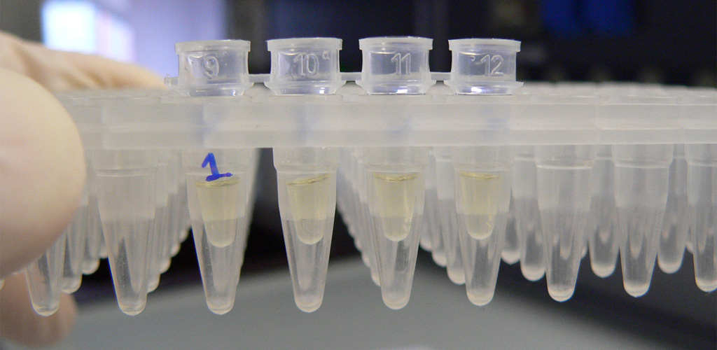 Computer System Validation